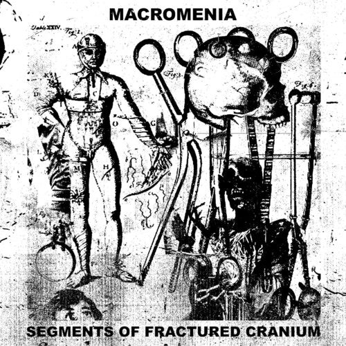 Macromenia Segments Of Fractured Cranium New CD
